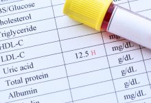 uric acid levels in the body